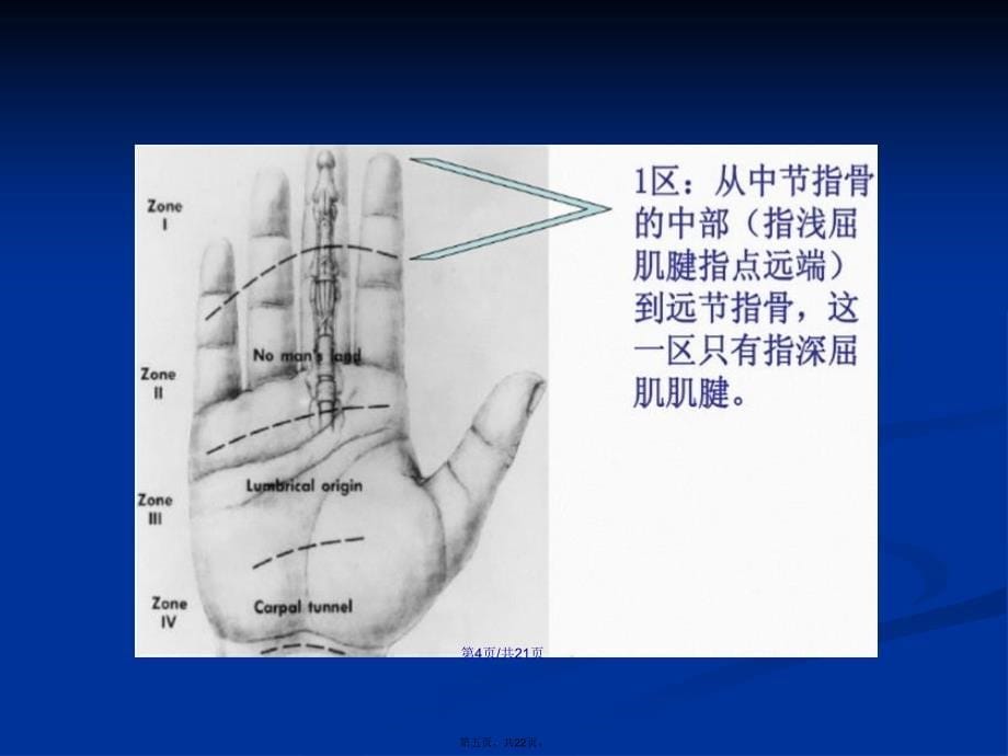 屈肌腱解剖与康复学习教案_第5页