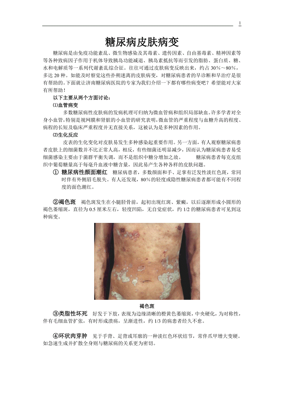 糖尿病皮肤病变.doc_第1页