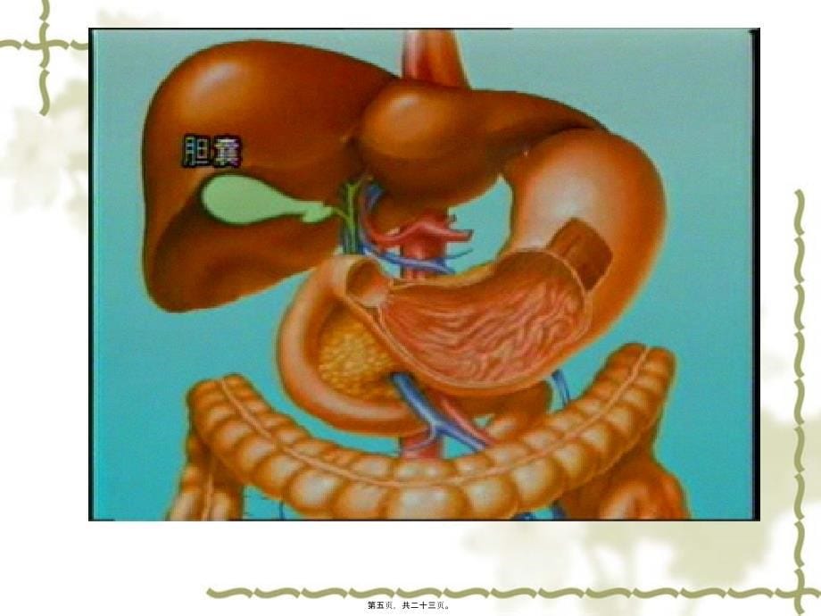 医学专题—胆囊结石和几种常见急性腹痛2519_第5页