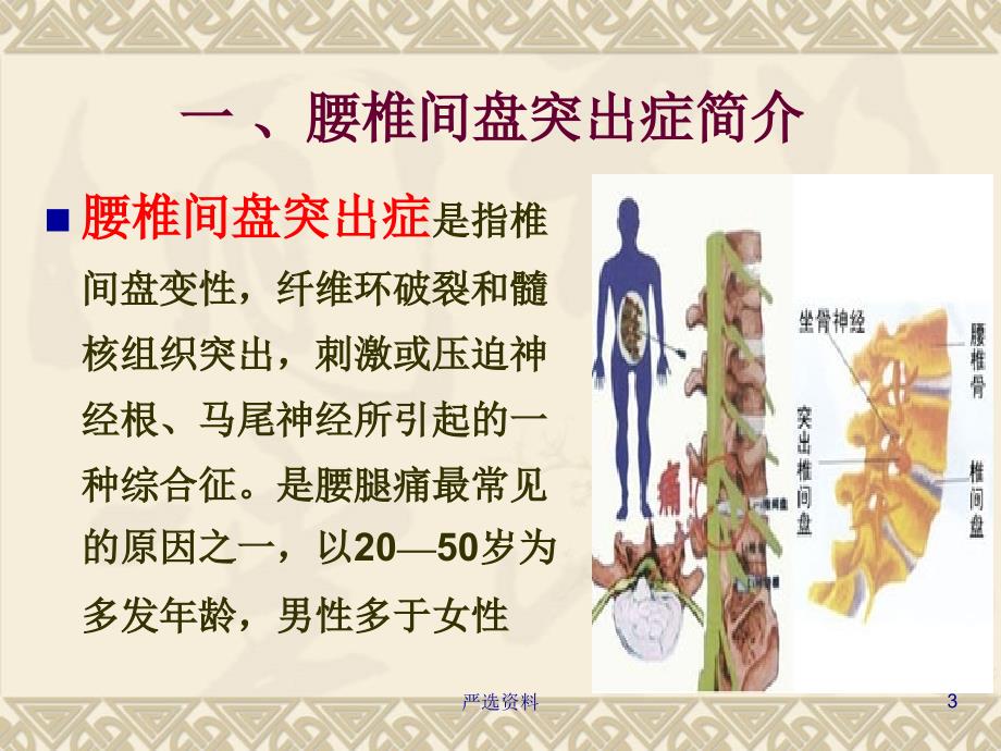 腰椎间盘突出症的健康教育（行业荟萃）_第3页