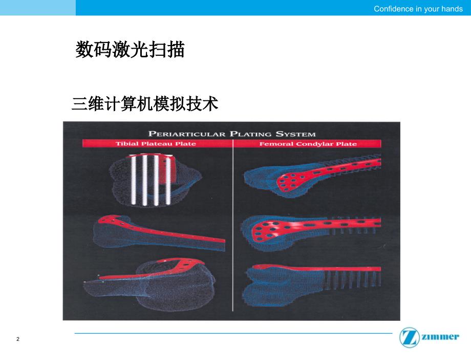 骨科手术钢板_第2页