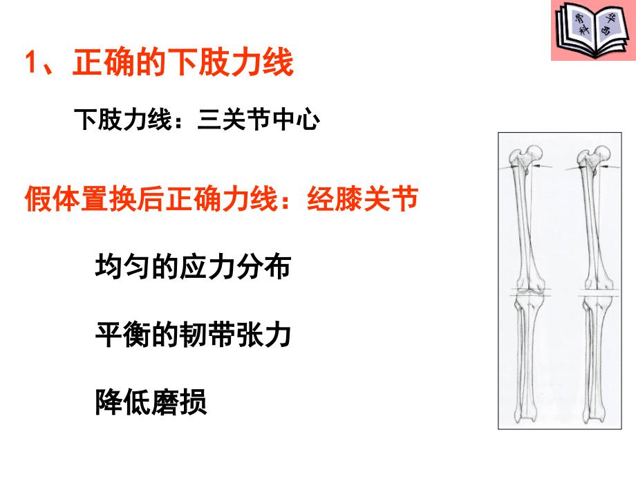 全膝关节置换的手术原则_第4页