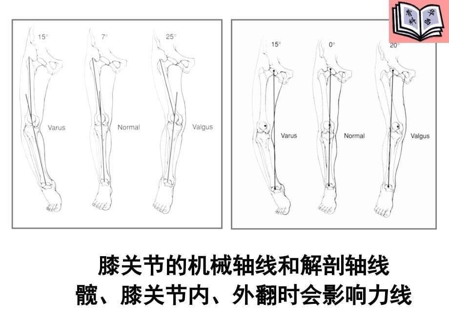 全膝关节置换的手术原则_第5页