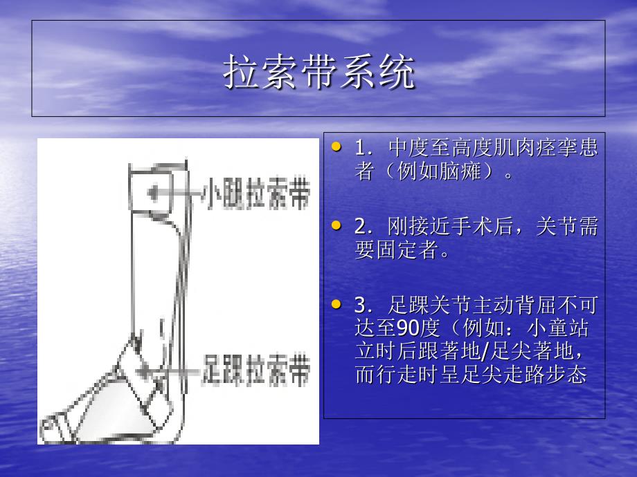 踝足成品矫形器杨林涛_第4页