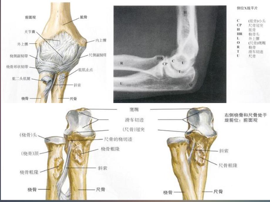 肘关节的X线常用测量及诊断分析.ppt_第4页