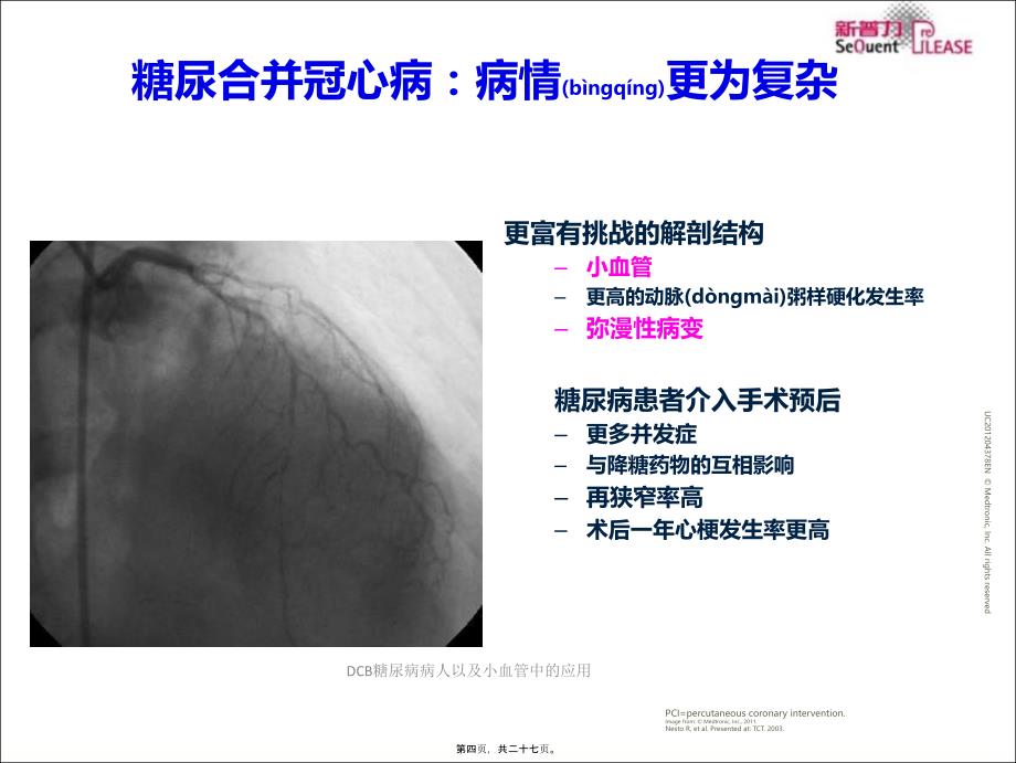 DCB糖尿病病人以及小血管中的应用课件_第4页