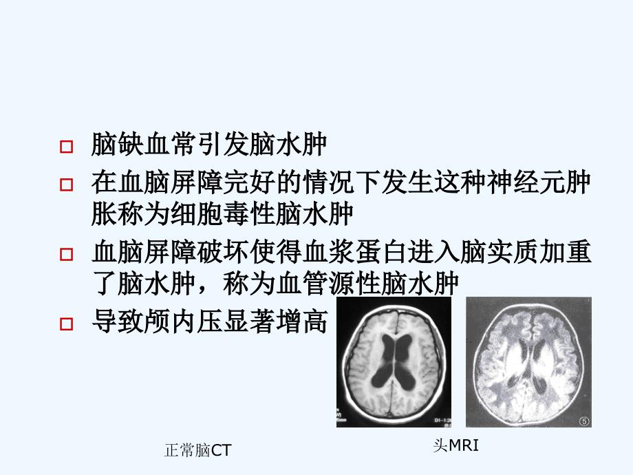 围术期脑保护进展-.._第4页