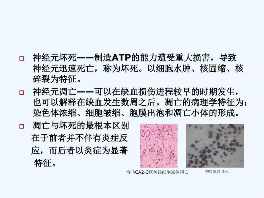 围术期脑保护进展-.._第5页