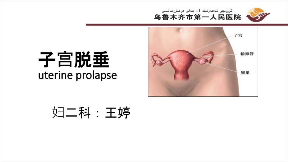 子宫脱垂ppt课件