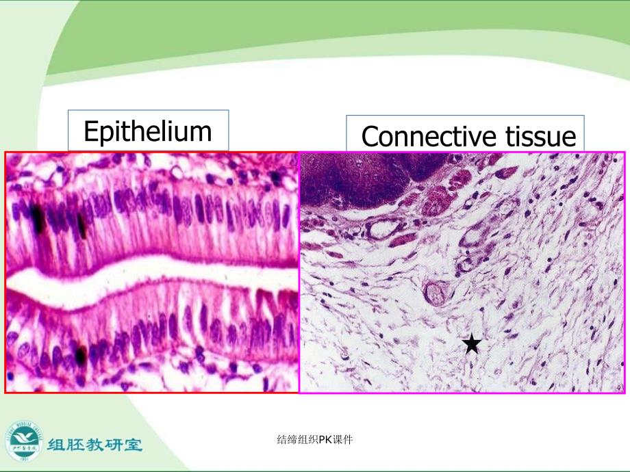结缔组织PK课件_第4页
