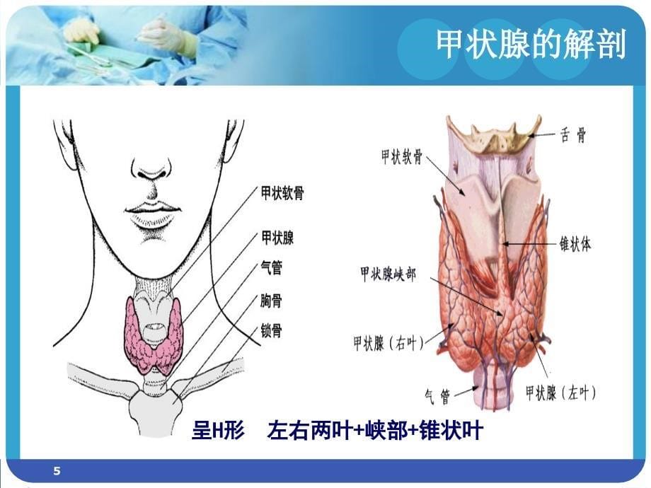 腔镜下甲状腺手术的护理查房PPT演示课件_第5页