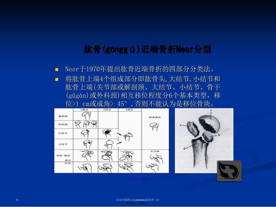 肱骨近端骨折分型及治疗学习教案_第5页