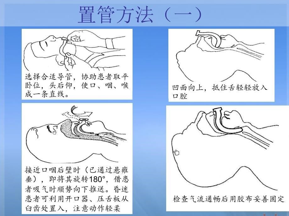 简易呼吸器ppt课件_第5页