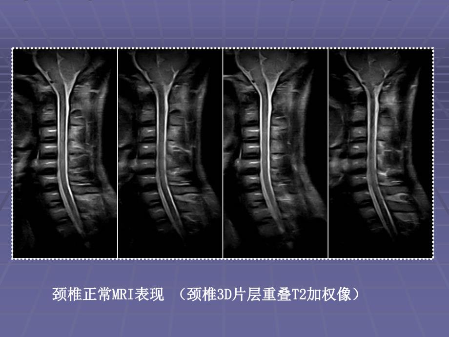 骨科影像学图像资料_第3页