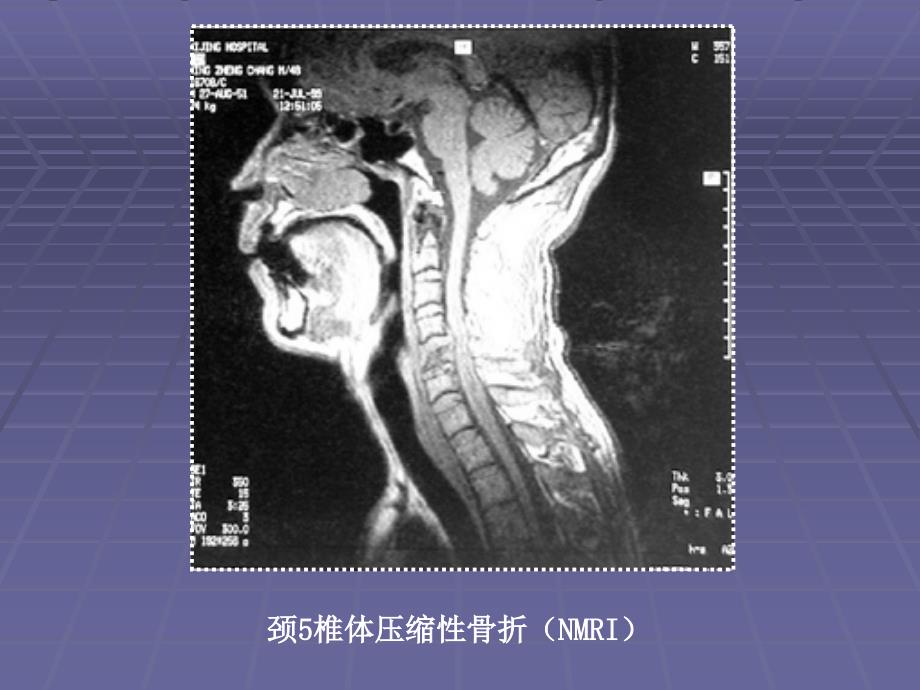 骨科影像学图像资料_第4页