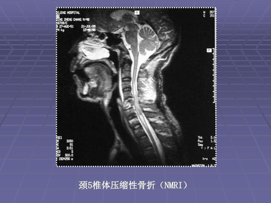 骨科影像学图像资料_第5页