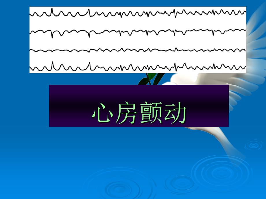 心房颤动课件PPT_第1页