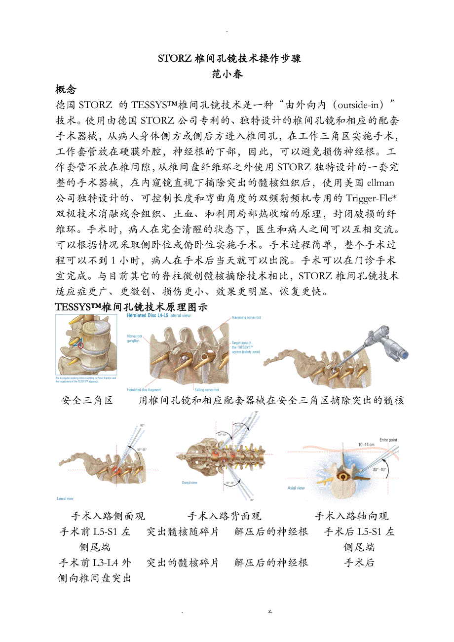 全部步骤椎间孔镜手术范小_第1页