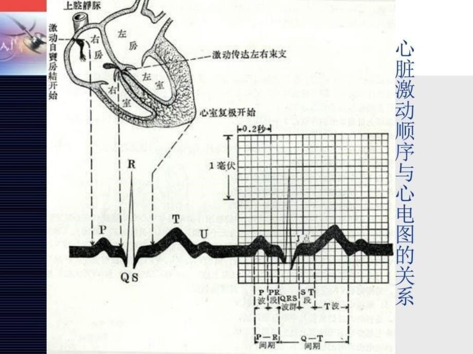 心律失常房早图文.ppt_第5页