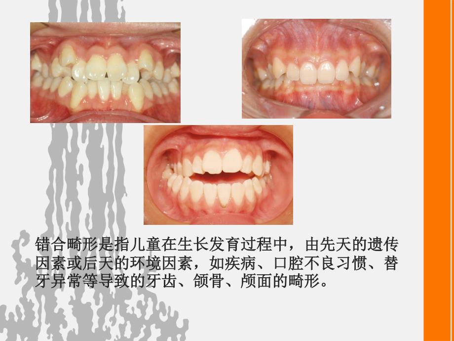 (1.1.1)--科学与艺术的统一-正畸矫治概论_第3页