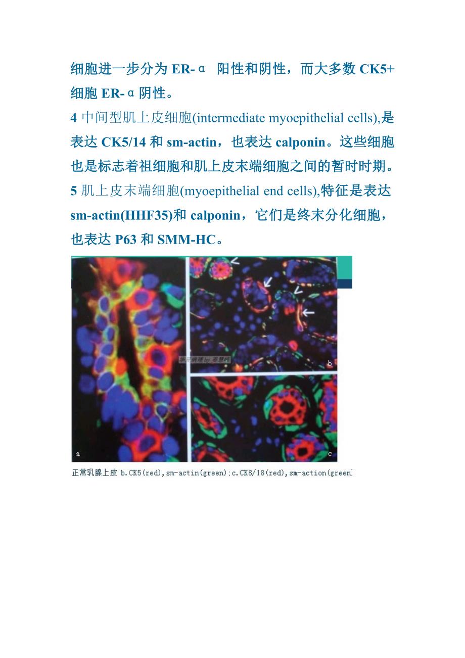 新概念方法解读乳腺导管内增生性病变.docx_第2页