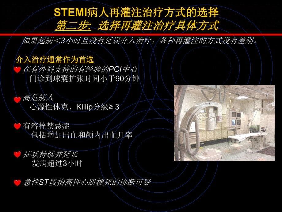 急性心肌梗死的介入治疗_第5页