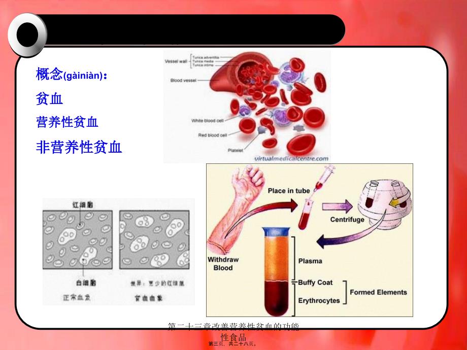 第二十三章改善营养性贫血的功能性食品课件_第3页