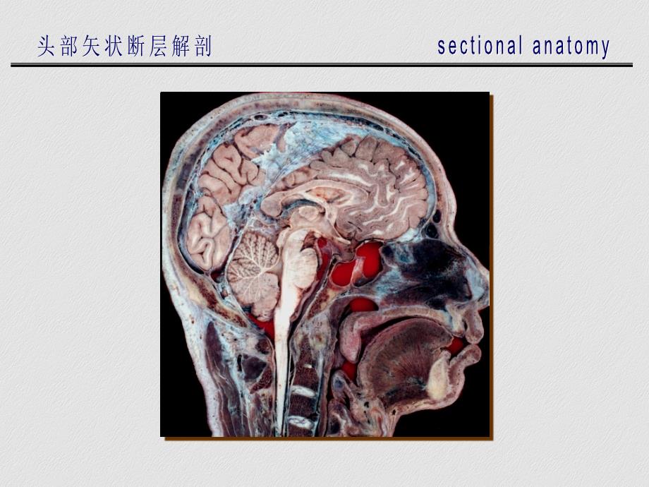 头部矢断层解剖_第3页