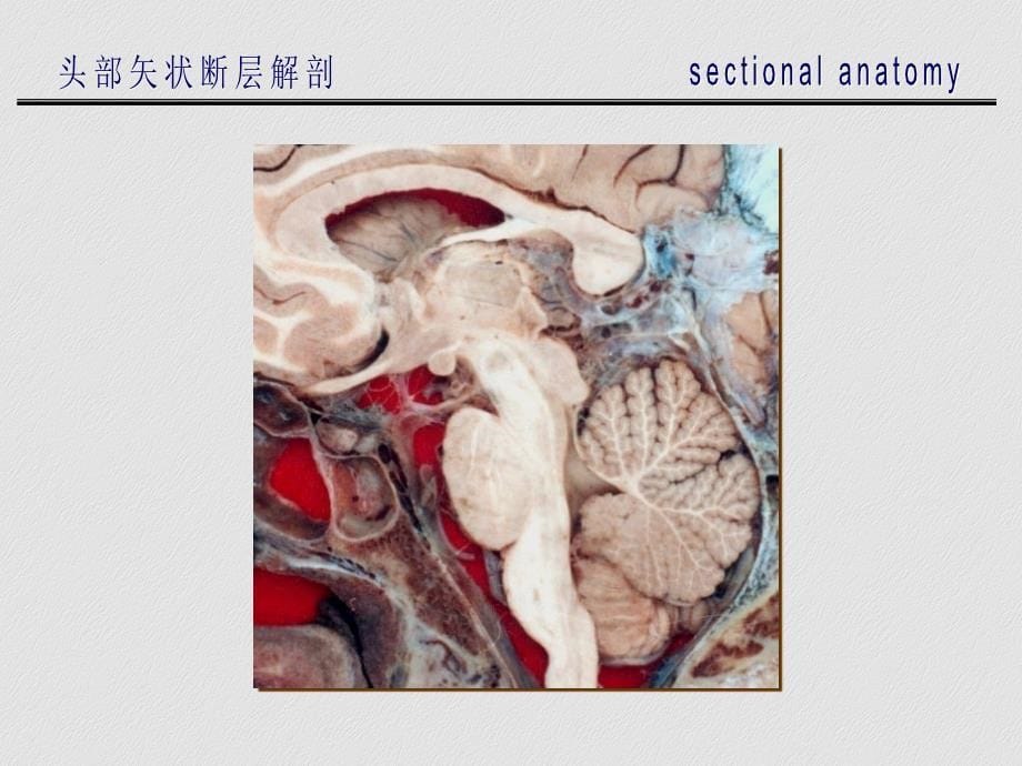 头部矢断层解剖_第5页