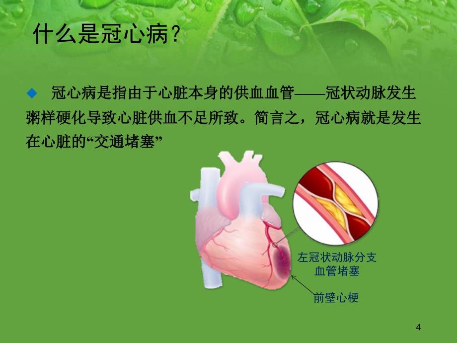 （优质课件）PCI术后健康教育_第4页