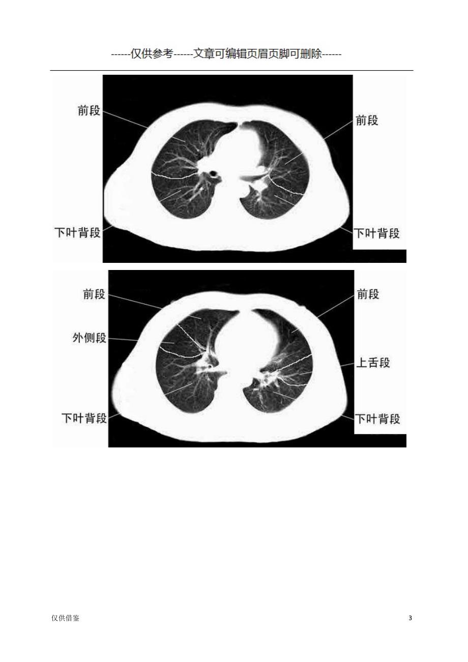 胸部CT肺段划分口诀[严选材料]_第3页