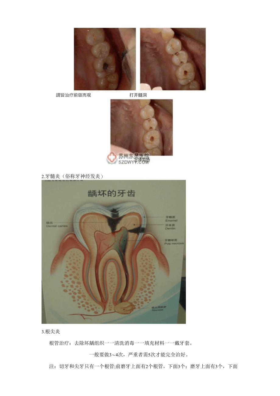 口腔常识培训_第4页