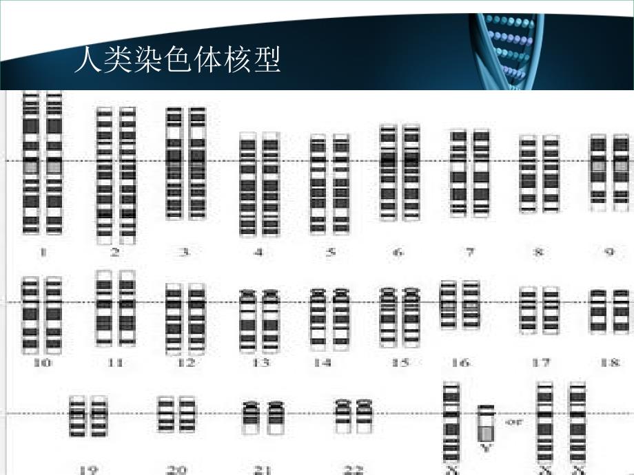 X染色体遗传病_第3页