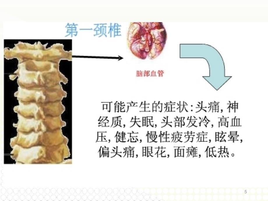 颈椎病诊疗及康复锻炼PPT精品文档_第5页