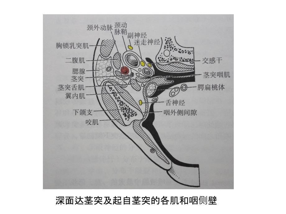 涎腺疾病影像诊断课件_第5页