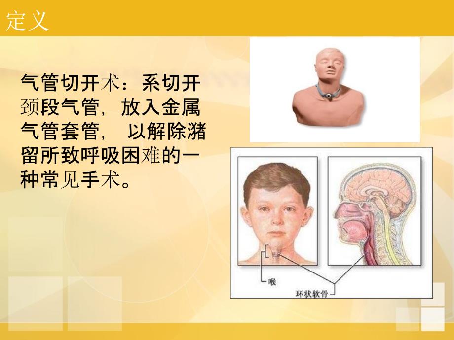 气管切开护理_第3页