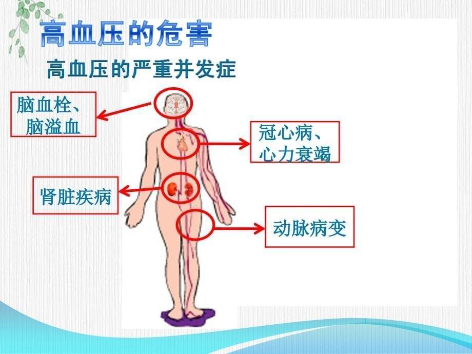 高血压防治讲座全课件_第5页