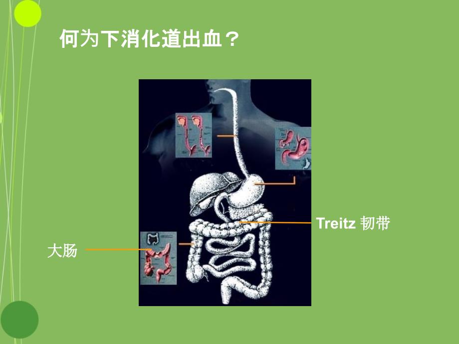 下消化道出血的诊治16519学习资料_第2页