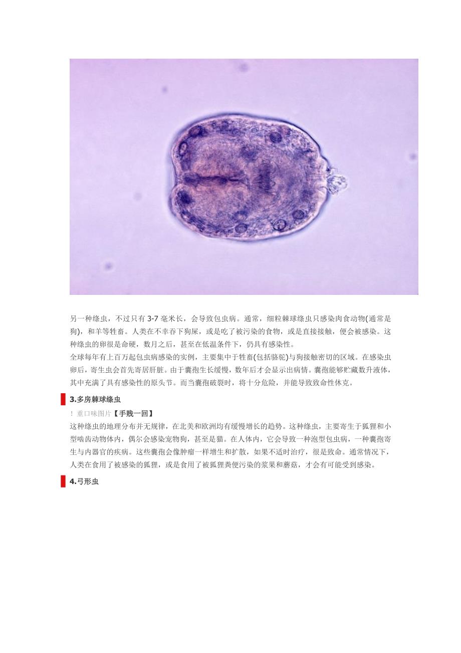 食物中可能带有的10种寄生虫.doc_第2页