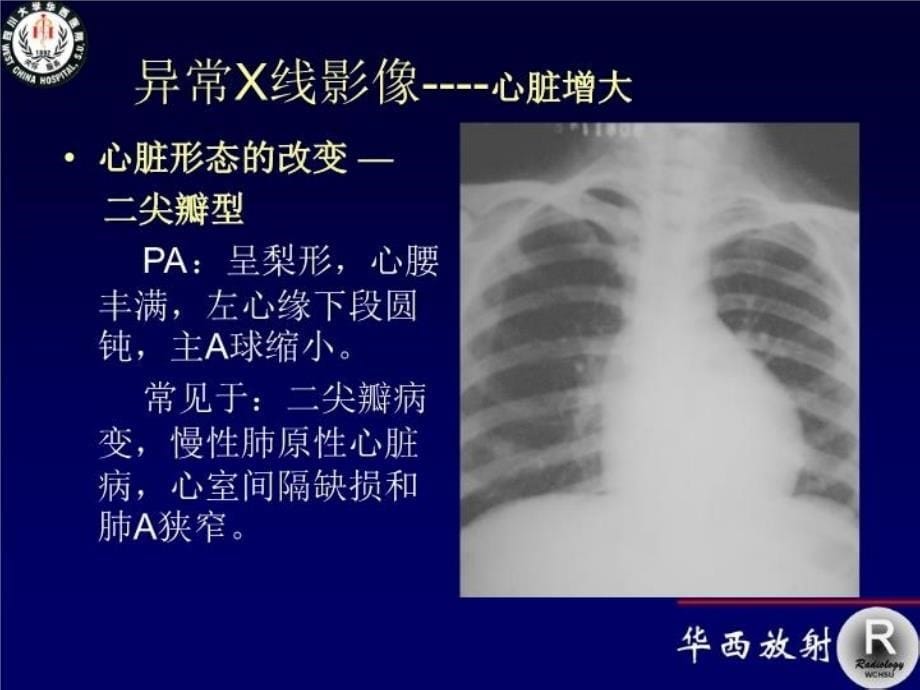 最新循环系统影像学22PPT课件_第5页