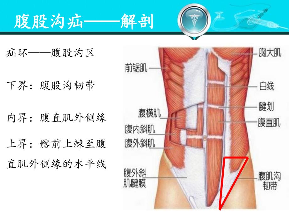 腹股沟疝——解剖腹外疝_第2页