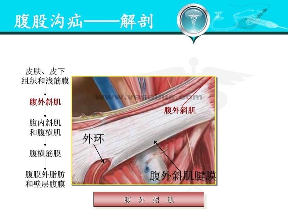 腹股沟疝——解剖腹外疝_第5页