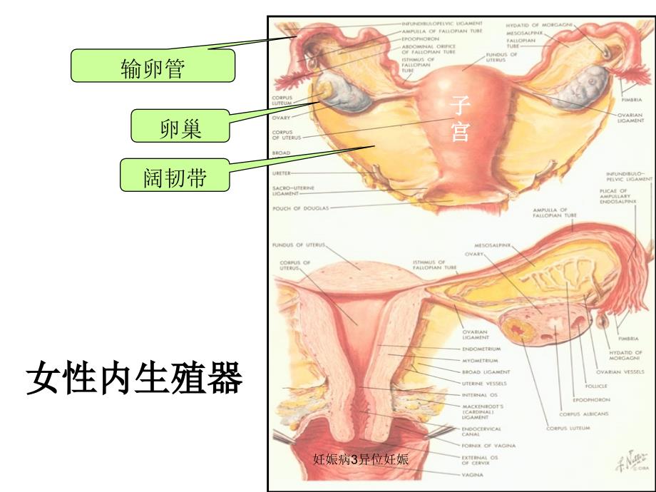 妊娠病3异位妊娠课件_第3页