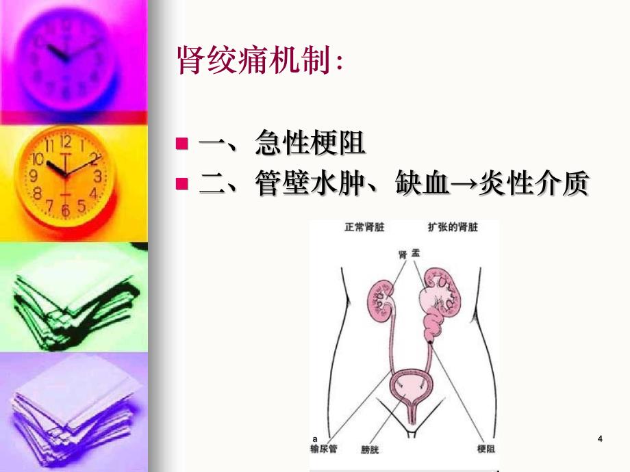 泌尿外科常见急症及处理要点_第4页