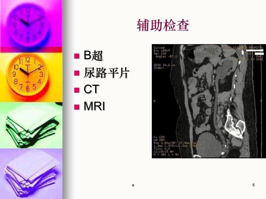 泌尿外科常见急症及处理要点_第5页