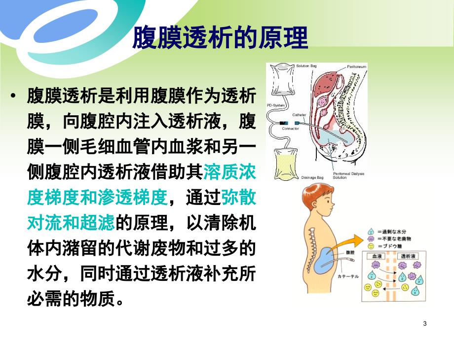 腹膜透析治疗PPT课件_第3页