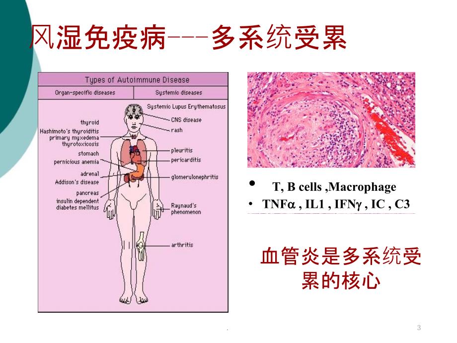 自身免疫性疾病的消化系统损害PPT课件_第3页