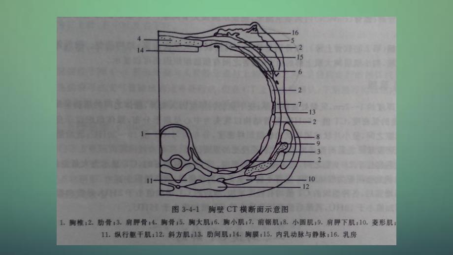 胸部CT解剖干货分享_第4页