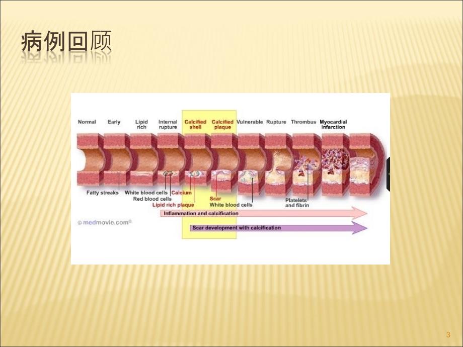 中心静脉置管与血栓形成ppt课件_第3页