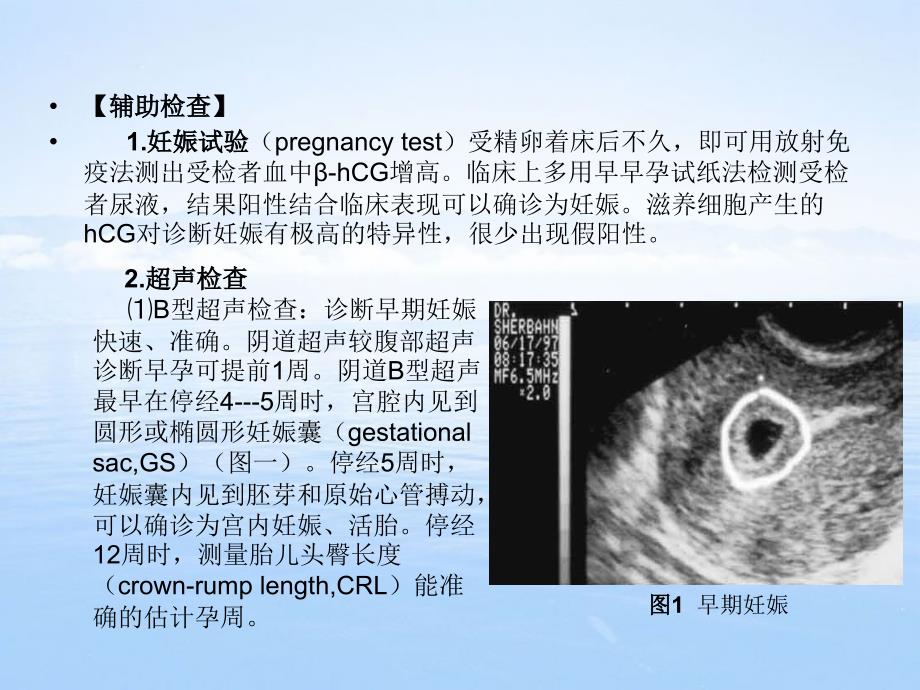 妊-娠-诊-断摘要_第4页